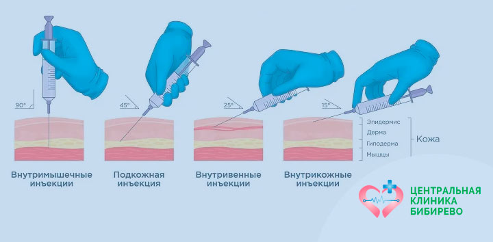 Уколы (инъекции) Бибирево, Алтуфьево, Бабушкинская
